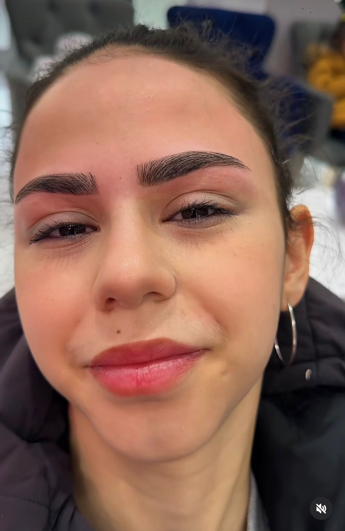 Altın Oran Kaş Alımı